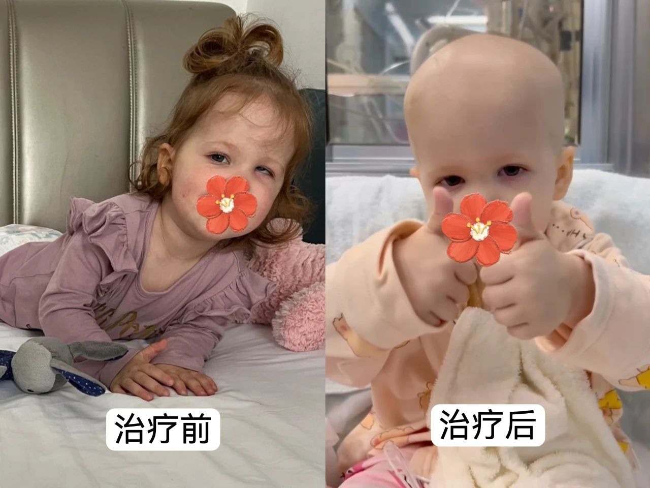 “你们创造了奇迹！”——瑞典罕见遗传病患儿万里赴粤基因治疗获得项目